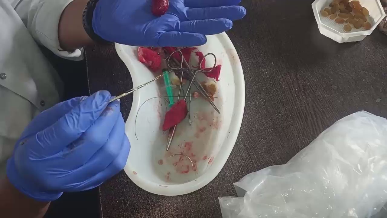 Load video: A poor Needy patient who received free surgery treatment by your contribution